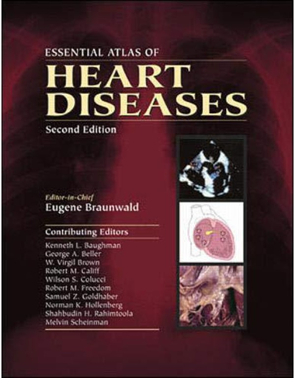 Essential Atlas of Heart Diseases