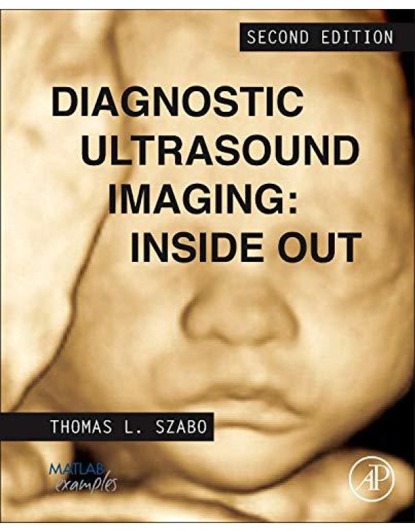 Diagnostic Ultrasound Imaging: Inside Out (Biomedi...