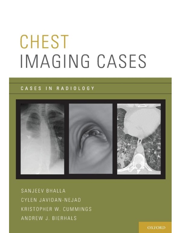 Chest Imaging Cases (Cases in Radiology)