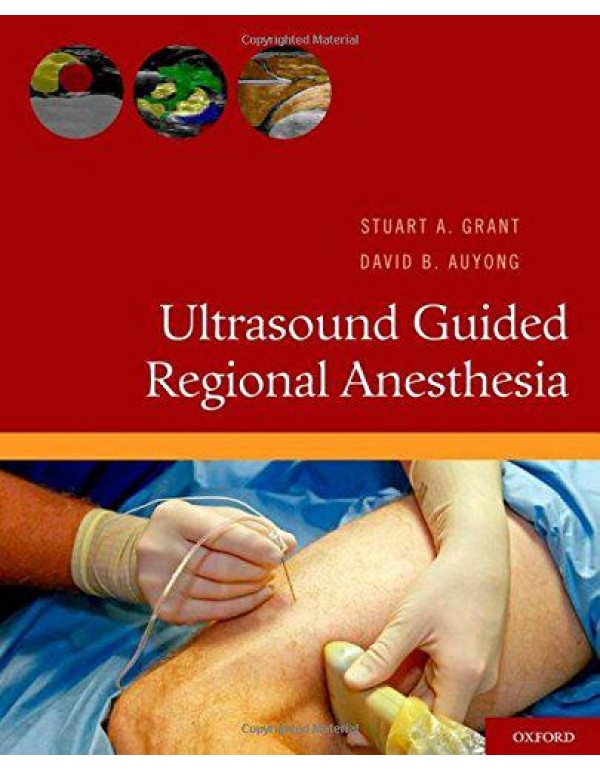 Ultrasound Guided Regional Anesthesia