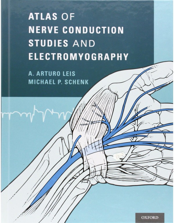 Atlas of Nerve Conduction Studies and Electromyogr...