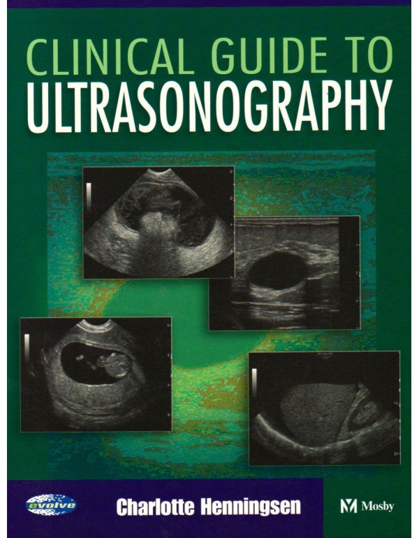 Clinical Guide to Ultrasonography