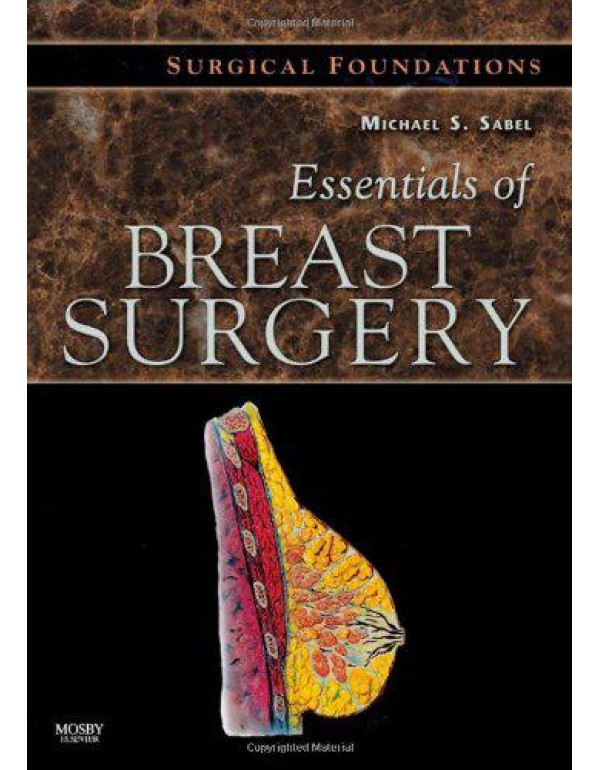 Essentials of Breast Surgery: A Volume in the Surg...