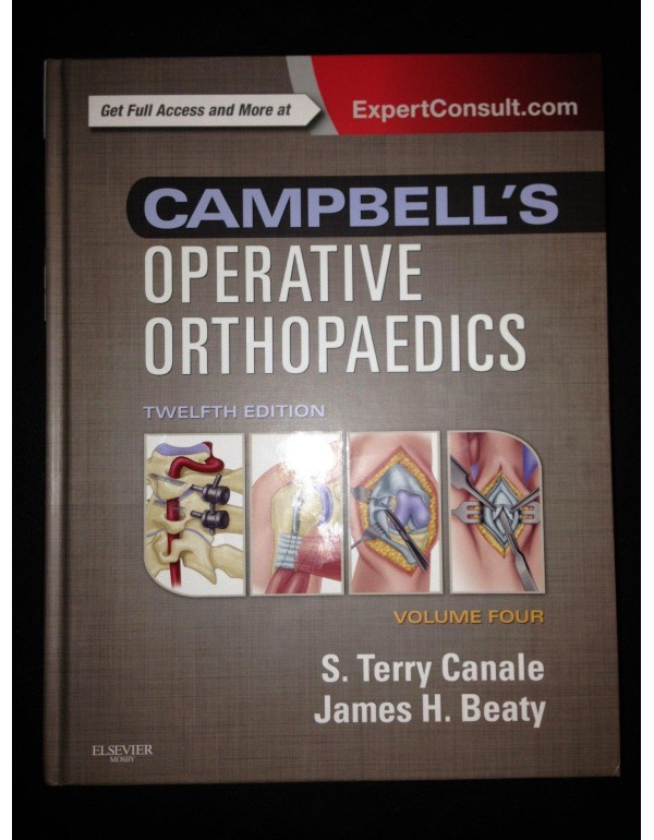 Campbell's Operative Orthopaedics: 4-Volume Set