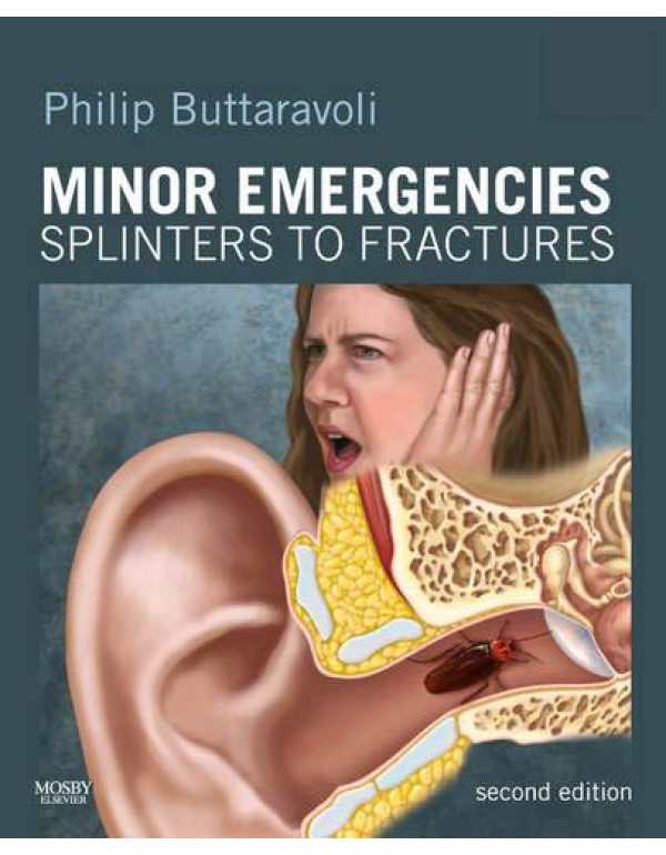 Minor Emergencies: Splinters to Fractures