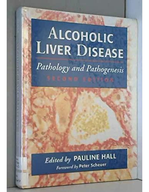 Alcoholic Liver Disease: Pathology and Pathogenesi...