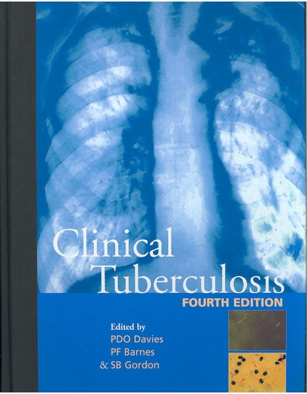 Clinical Tuberculosis (A Hodder Arnold Publication...