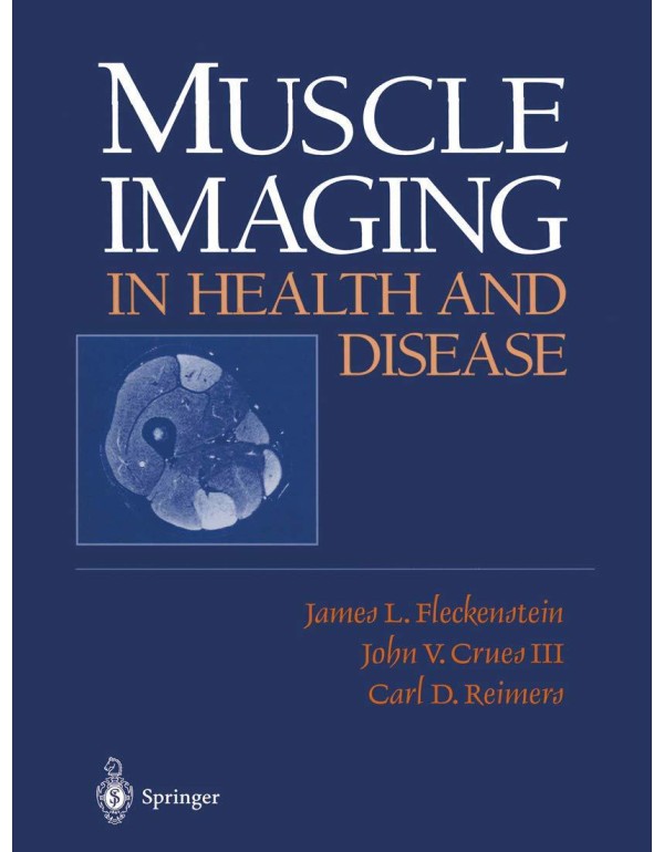 Muscle Imaging in Health and Disease