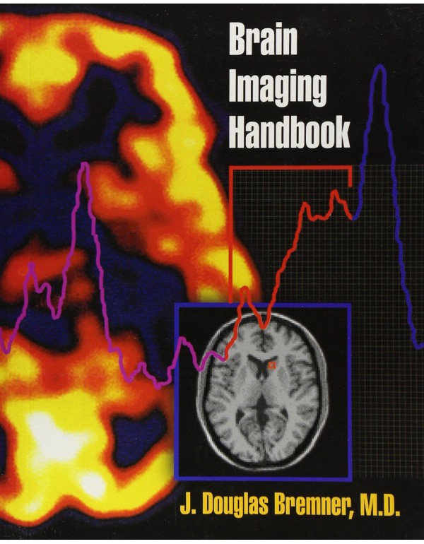 Brain Imaging Handbook