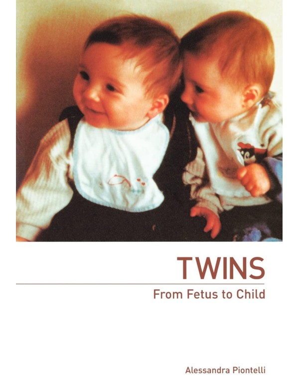 Twins - From Fetus to Child