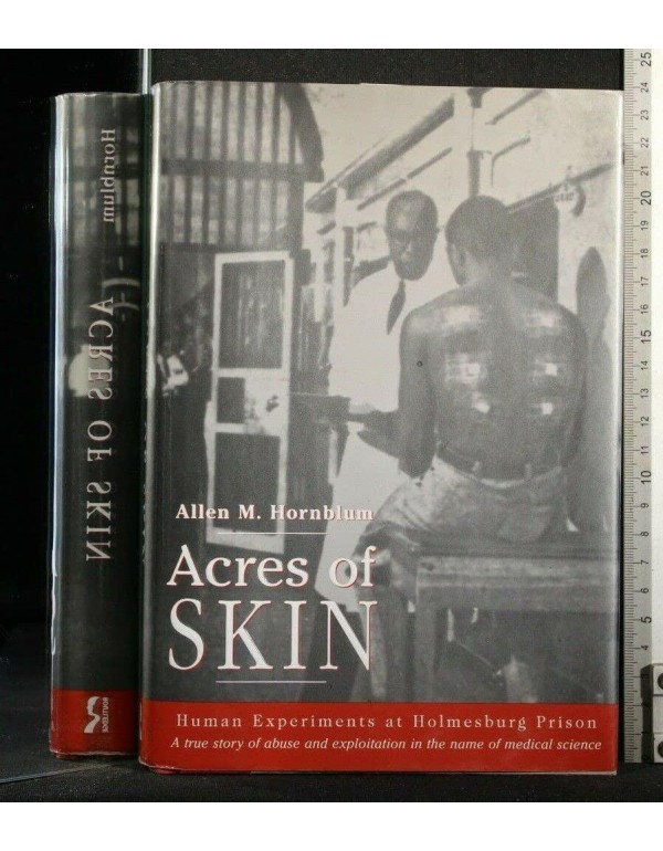 Acres of Skin: Human Experiments at Holmesburg Pri...