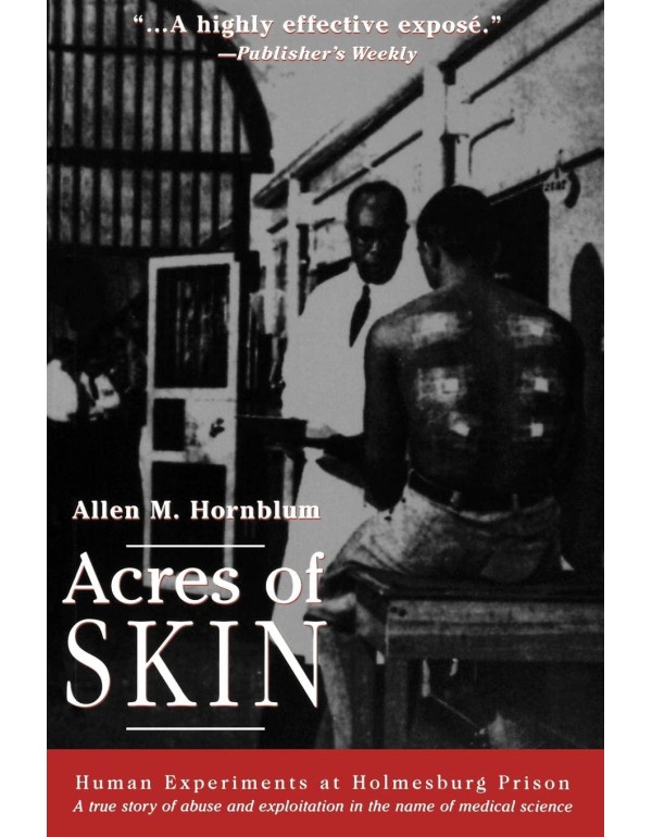 Acres of Skin: Human Experiments at Holmesburg Pri...