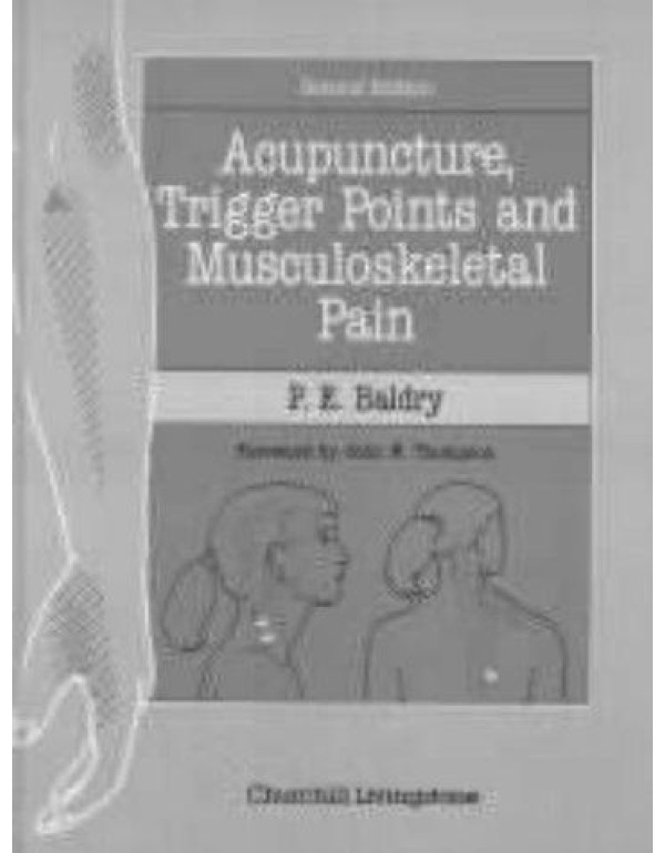 Acupuncture, Trigger Points and Musculoskeletal Pa...