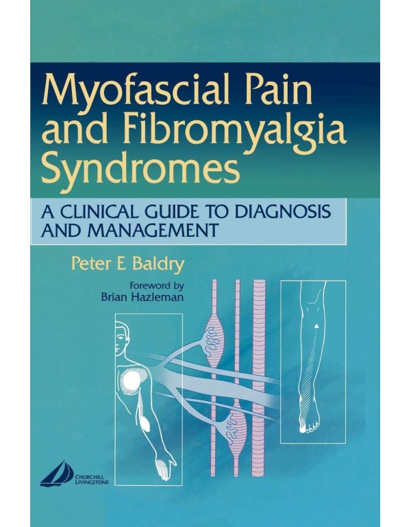 Myofascial Pain and Fibromyalgia Syndromes: A Clin...