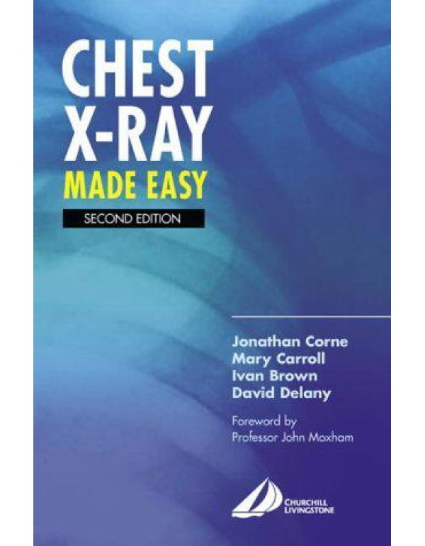 Chest X-Ray Made Easy