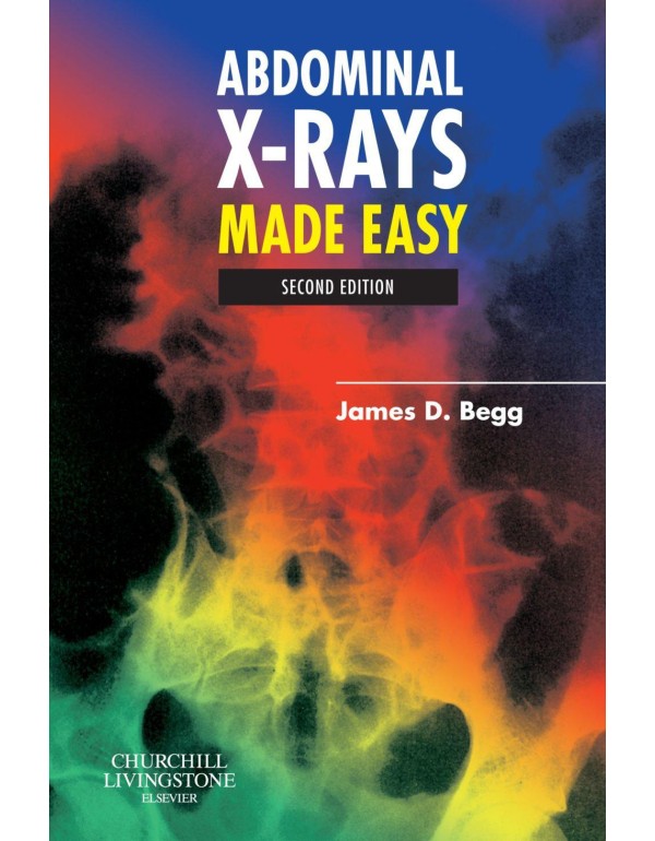 Abdominal X-Rays Made Easy