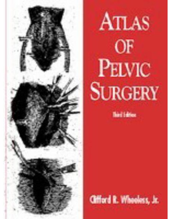 Atlas of Pelvic Surgery