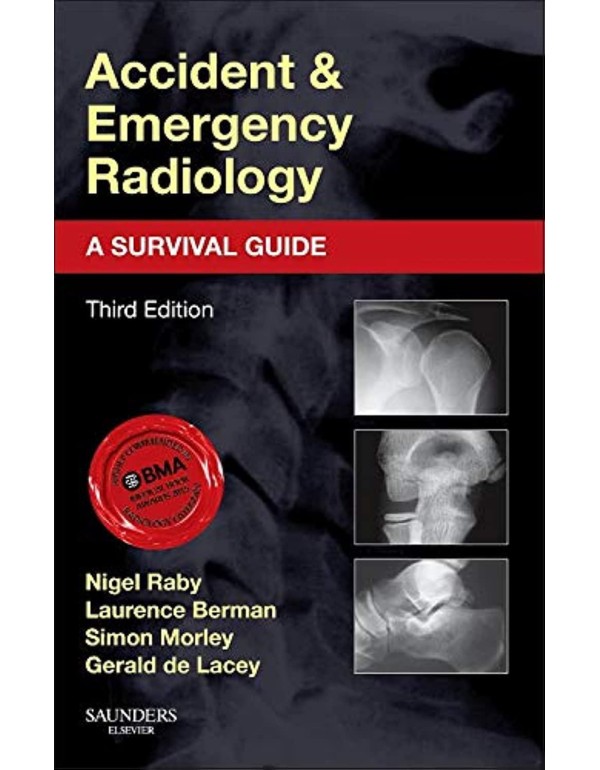 Accident and Emergency Radiology: A Survival Guide