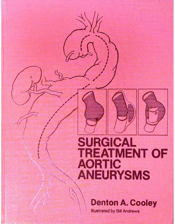 Surgical Treatment of Aortic Aneurysms