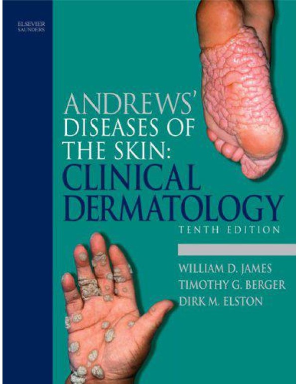 Andrews' Diseases of the Skin: Clinical Dermatolog...