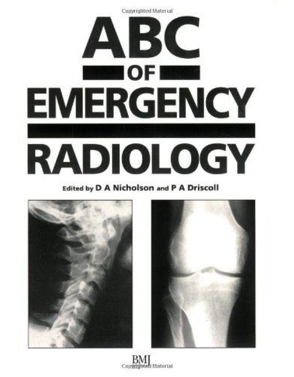 ABC of Emergency Radiology (ABC Series)