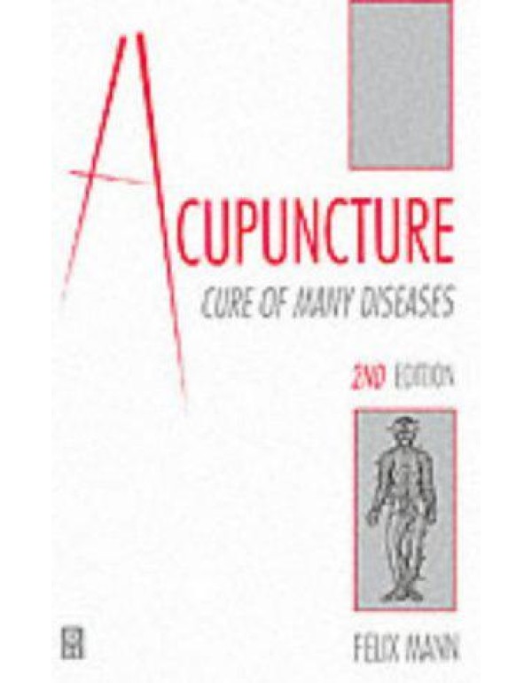 Acupuncture: Cure of Many Diseases