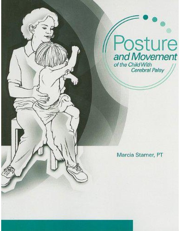 Posture and Movement of the Child With Cerebral Pa...