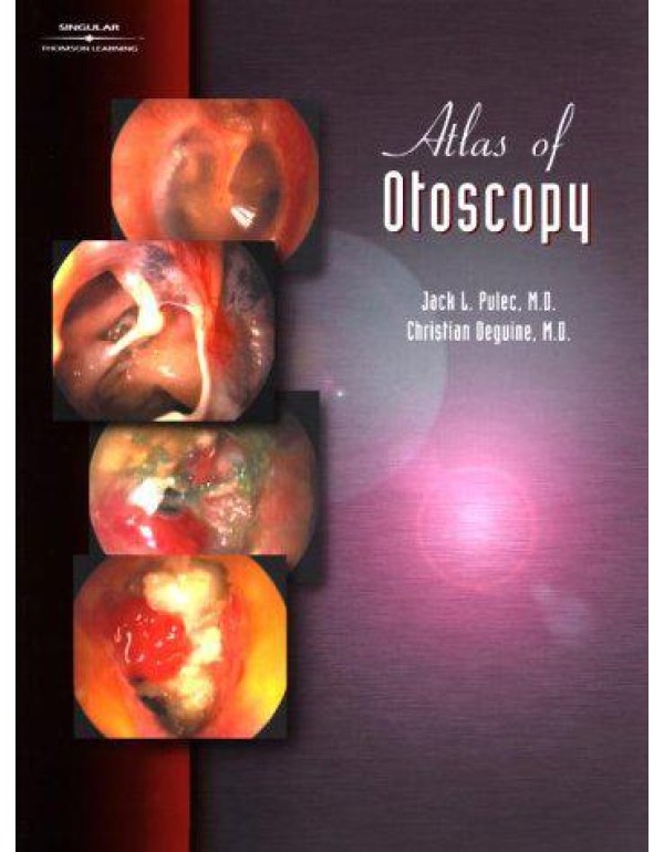 Atlas of Otoscopy