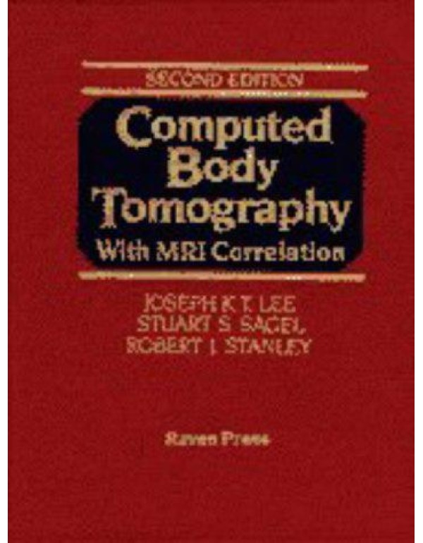 Computed Body Tomography with MRI Correlation (2 V...