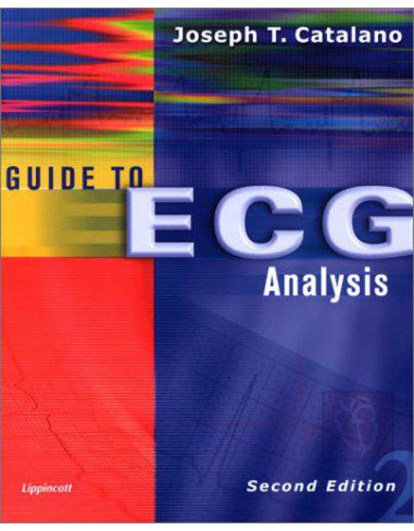 Guide to Ecg Analysis