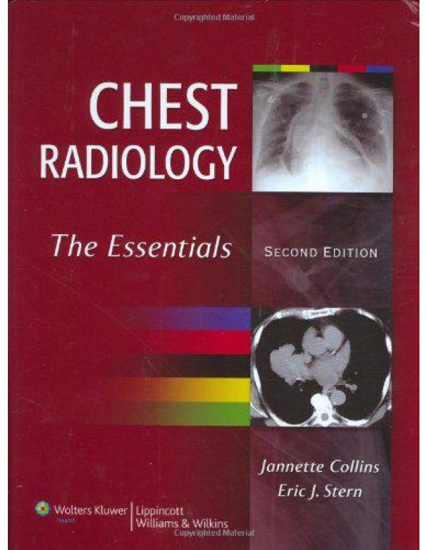 Chest Radiology: The Essentials