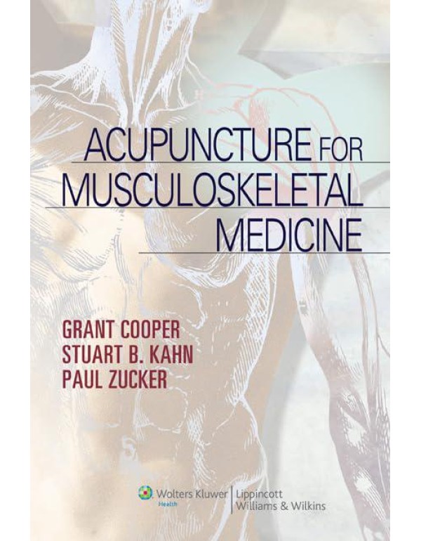 Acupuncture for Musculoskeletal Medicine