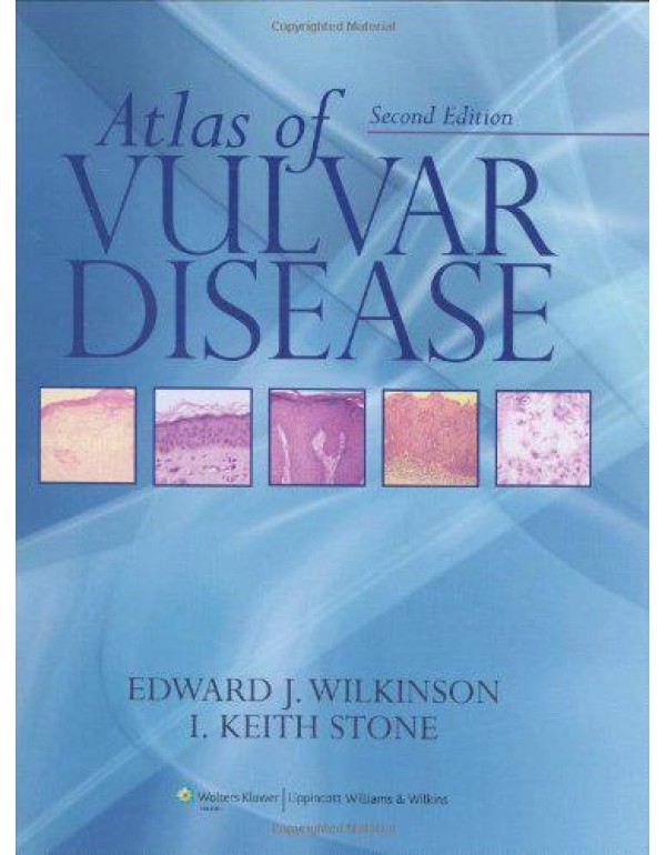 Atlas of Vulvar Disease