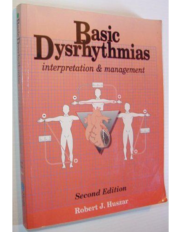 Basic Dysrhythrams Interpretations & Management