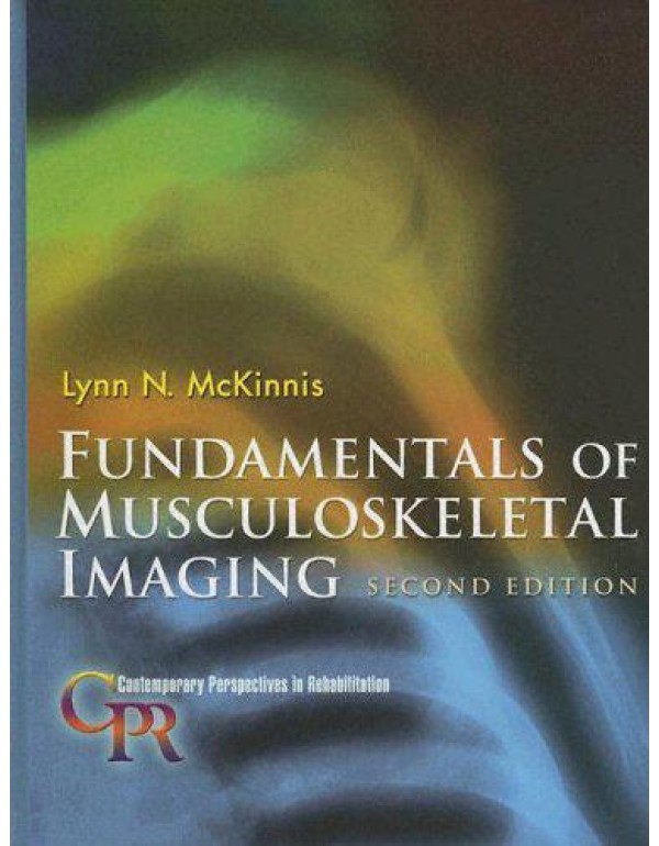 Fundamentals of Musculoskeletal Imaging (Contempor...