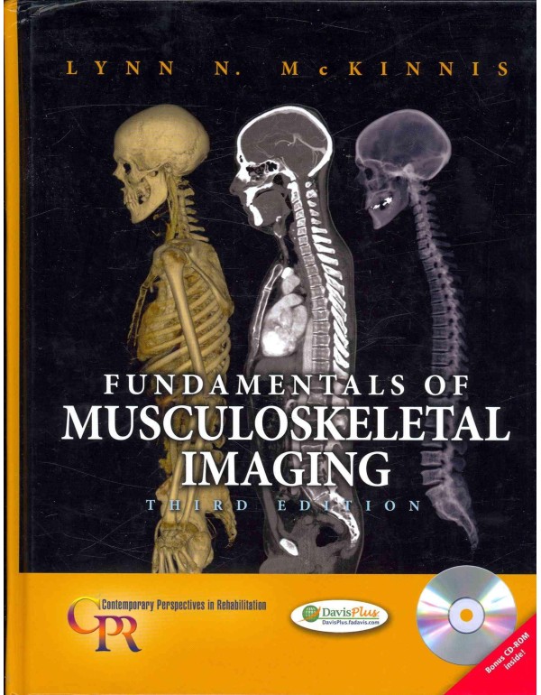 Fundamentals of Musculoskeletal Imaging (Contempor...