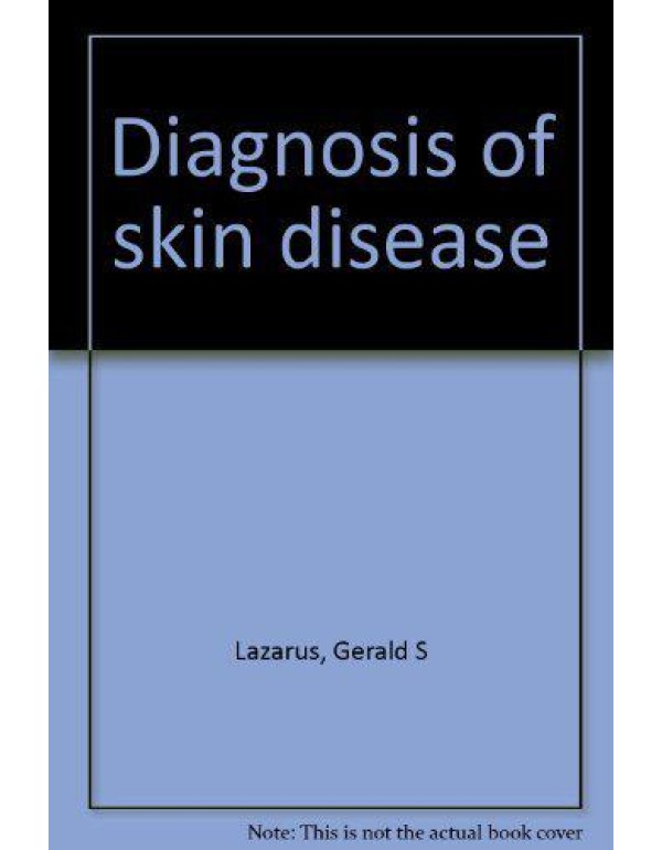 Diagnosis of skin disease