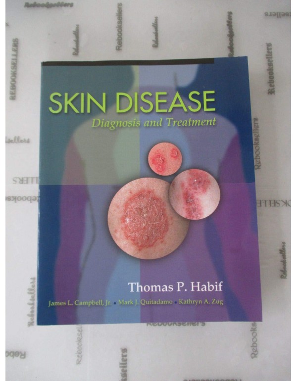 Skin Disease: Diagnosis And Treatment